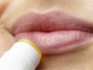 Chapped lips - picture of lip balm being applied.